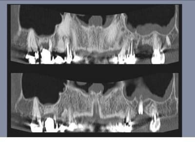 Image006 cbpywi - Eugenol