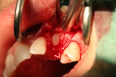 Img 0332 kx3fw4 - Eugenol