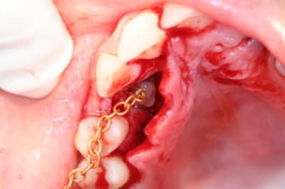 Img 0345 tt0p2i - Eugenol