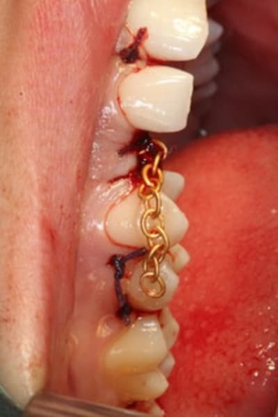 Img 0352 blodop - Eugenol