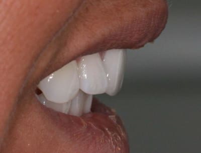 Img 6476 cwzvgm - Eugenol