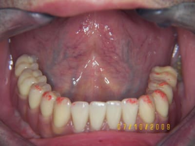 In situ vgs7sz - Eugenol