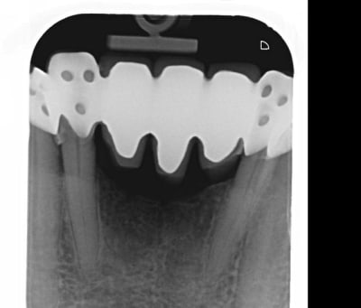 Inf2 gktiom - Eugenol