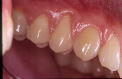 Initial qoccpw - Eugenol