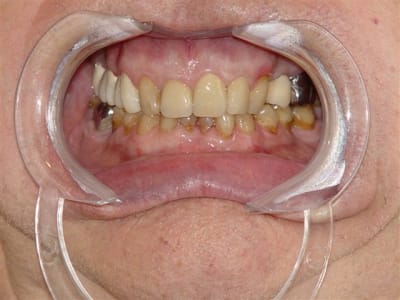 Intermédiaire kf85pr - Eugenol