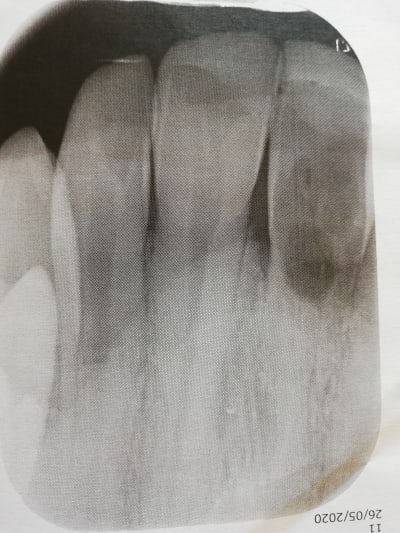 Iruakkrwdwjatrbi5tbm - Eugenol