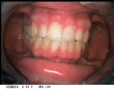 Jeris2 n1sycy - Eugenol