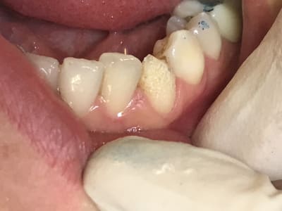 Jjsdtxg3fcaclwtstrlp - Eugenol