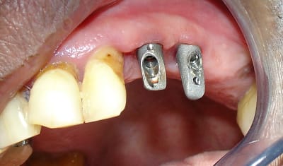 Jnn31mjqa0cwzgxtmj3k - Eugenol