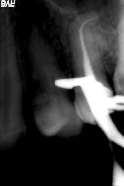 Jo2 hngdfs - Eugenol