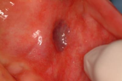 Kézaco yeymsq - Eugenol