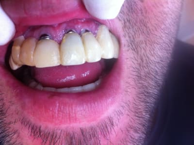 K 1 vjnkoi - Eugenol