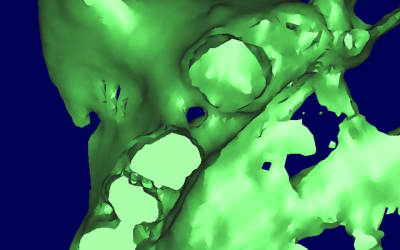 Karine 3d lehmdt - Eugenol