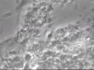 Keskesé wipgud - Eugenol