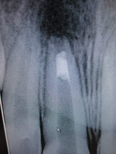 L o 2009 yrvpzp - Eugenol