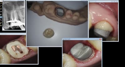 Labocast 26 xfqr3m - Eugenol