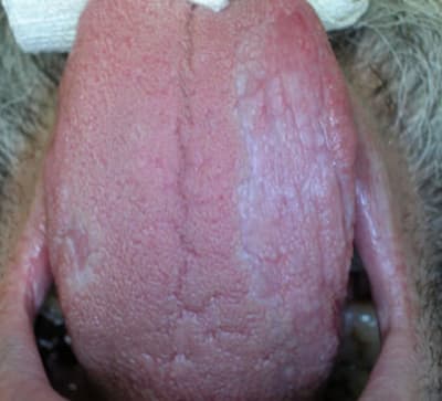 Langue clmcyb - Eugenol