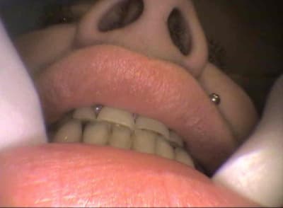 Lar2 lqb6sn - Eugenol