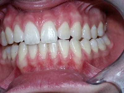 Latéralitégauche o6su6y - Eugenol