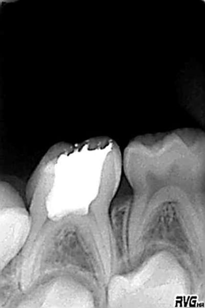 Laura fev 06 d0mbfj - Eugenol