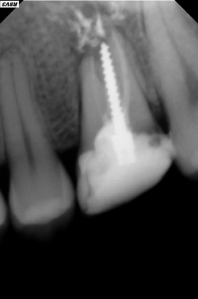 Lay gvsvou - Eugenol