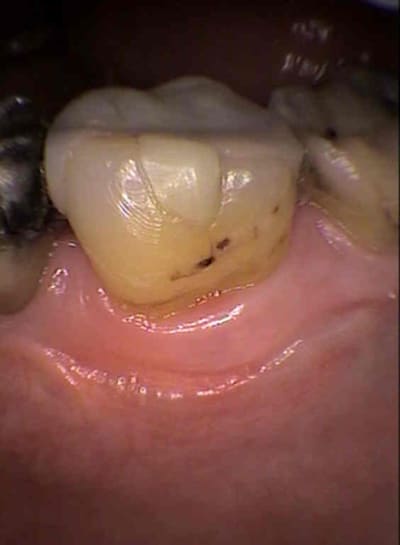 Les inter 2 t3pcek - Eugenol