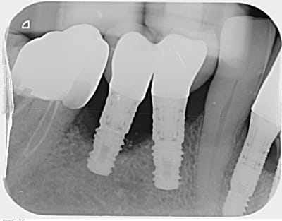 Lhjliwwjirjh99cn5cxa - Eugenol