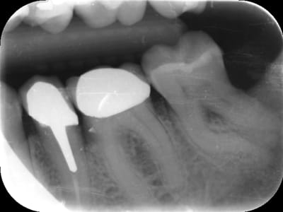 Lor jnuiii - Eugenol