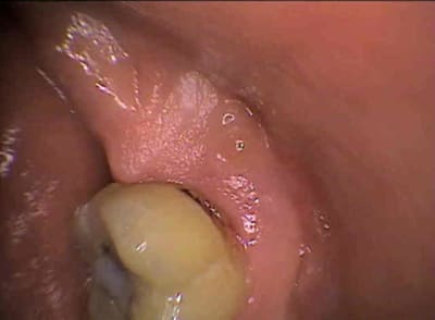 Lorenzi uef3ry - Eugenol