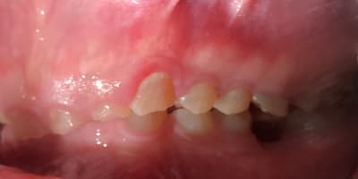 Ltwdegz8enxhywlq9hon - Eugenol