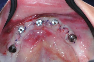 Lviitudzqzmvkc7rw2kv - Eugenol