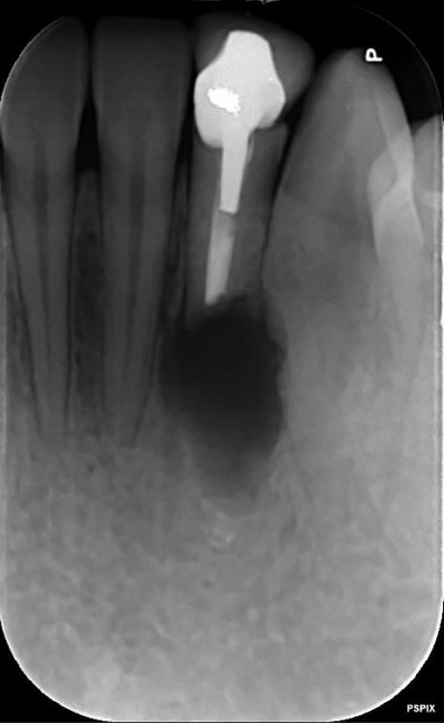 Lzh1bqfhe0gtn5h6w797 - Eugenol