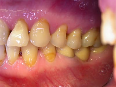 Madame t3 lcbgrd - Eugenol