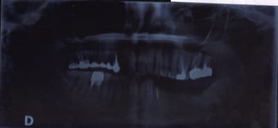 Madamef yo7yze - Eugenol