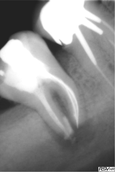 Marroux2 ylb0wc - Eugenol