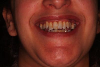 Mars2016 074 rjs99m - Eugenol