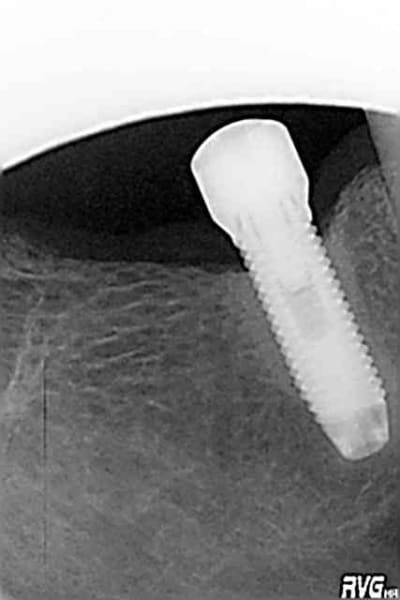 Masc qxdkqp - Eugenol