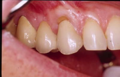 Maturation tjxawt - Eugenol