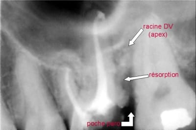 Maz 2 ww3zcj - Eugenol