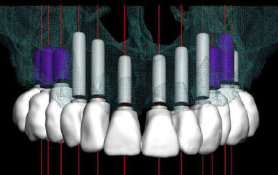 Mci2 djn9if - Eugenol