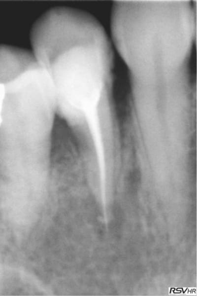 Mekb3 s2mvnq - Eugenol