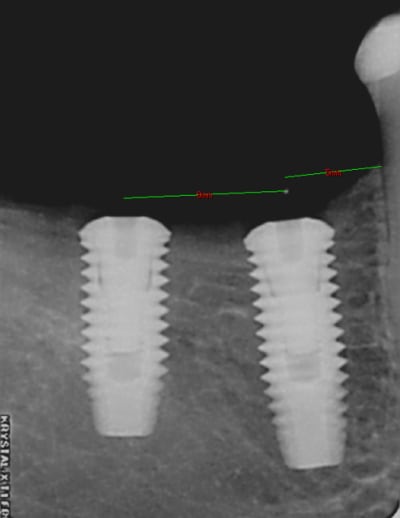 Mesures mf48ym - Eugenol