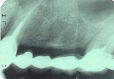 Mfretrosup1 trhobp - Eugenol