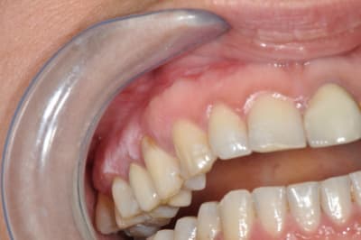 Miremont 002 ijshma - Eugenol