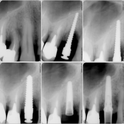 Mise en vitrine jvhxtm - Eugenol