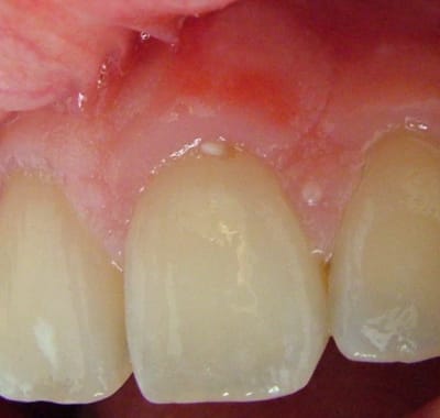 Mo3 lcqlii - Eugenol