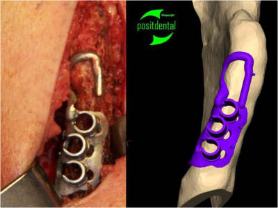 Mod le 3d st rile guide de d coupe 2 nggxml - Eugenol