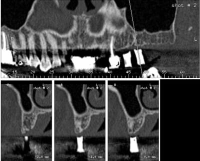Molaire2 ebvqpw - Eugenol