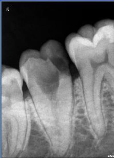 Monoradiculee it1bie - Eugenol