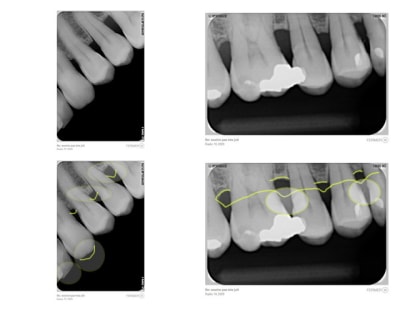 Montage radio a3l36a - Eugenol